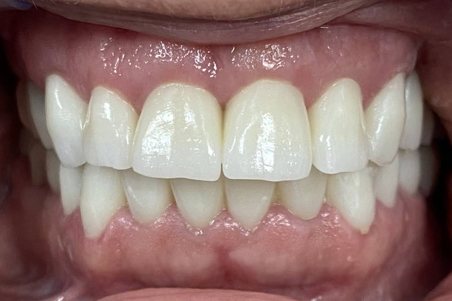 make your smile prosthodontics
